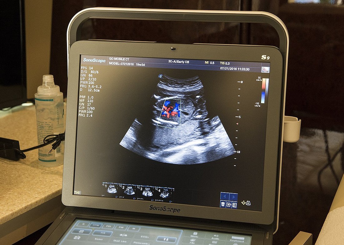 An ultrasound is seen in this file photo. (OSV News photo/Thomas Serafin, courtesy Knights of Columbus)