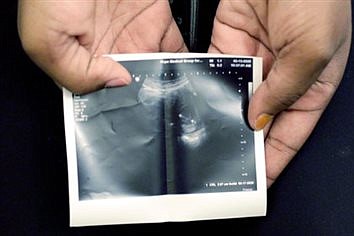 'ABORTION ON DEMAND'