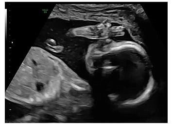 PEACE BEGINS IN THE WOMB